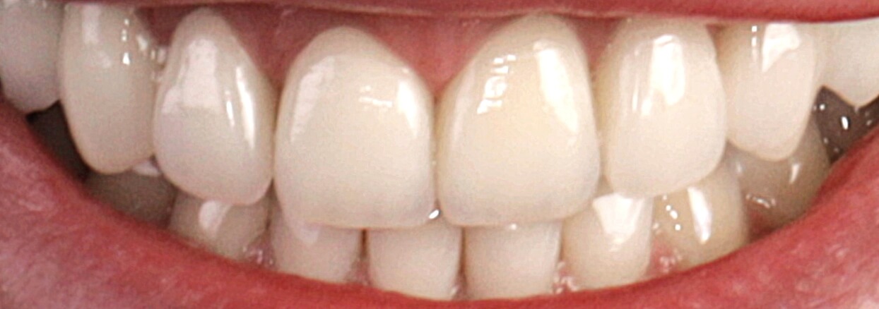 After